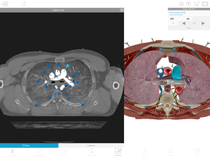 Human Anatomy Atlas 2020: Complete 3D Human Body 10